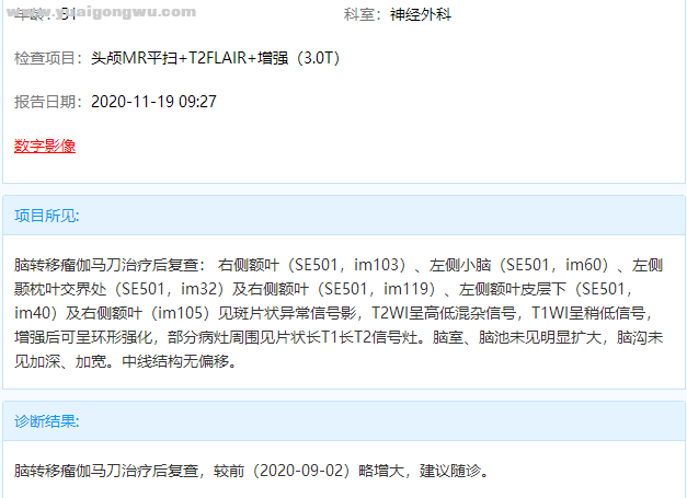 脑部核磁报告