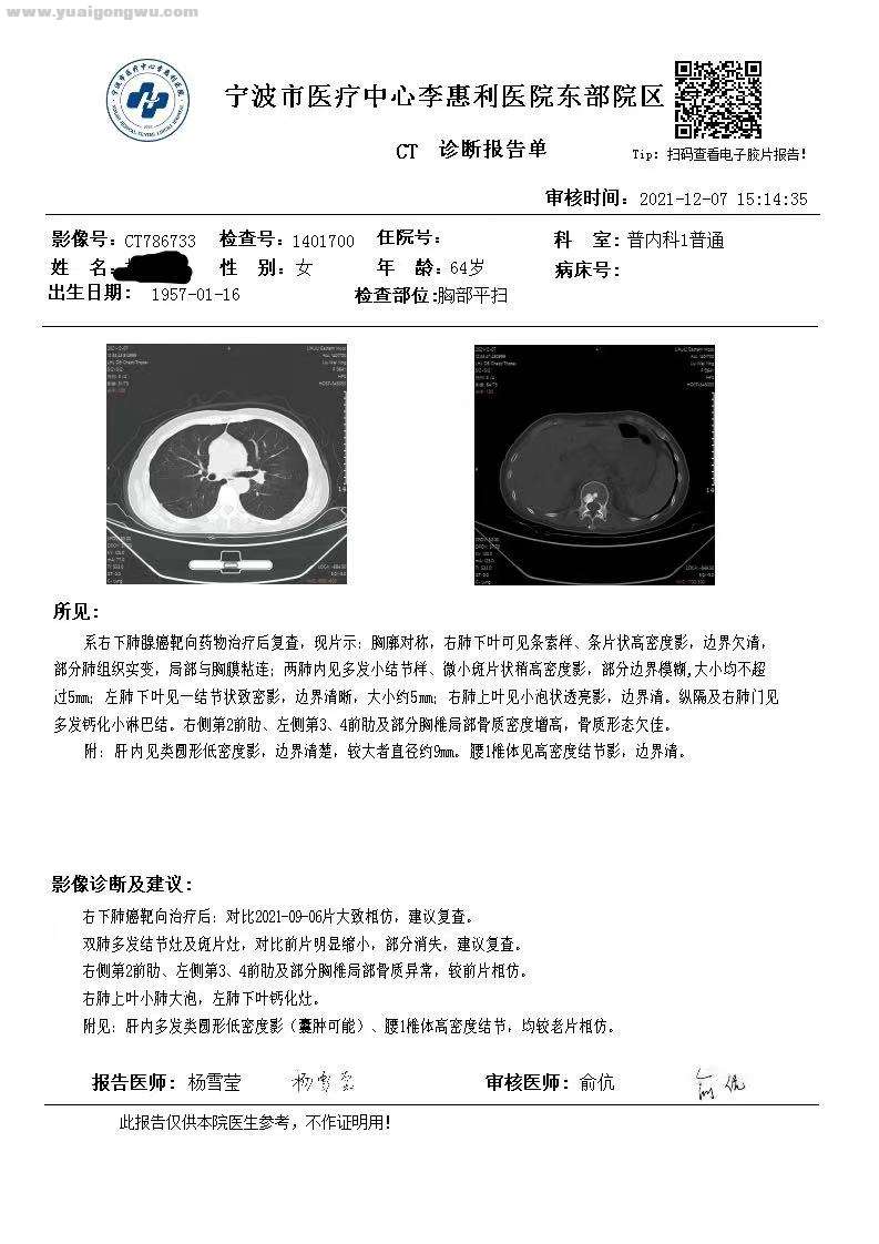 胸部CT2021.12