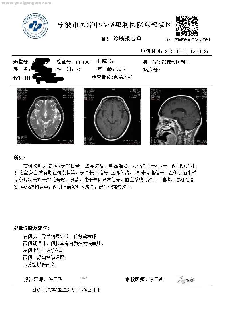 脑部增强MR2021.12