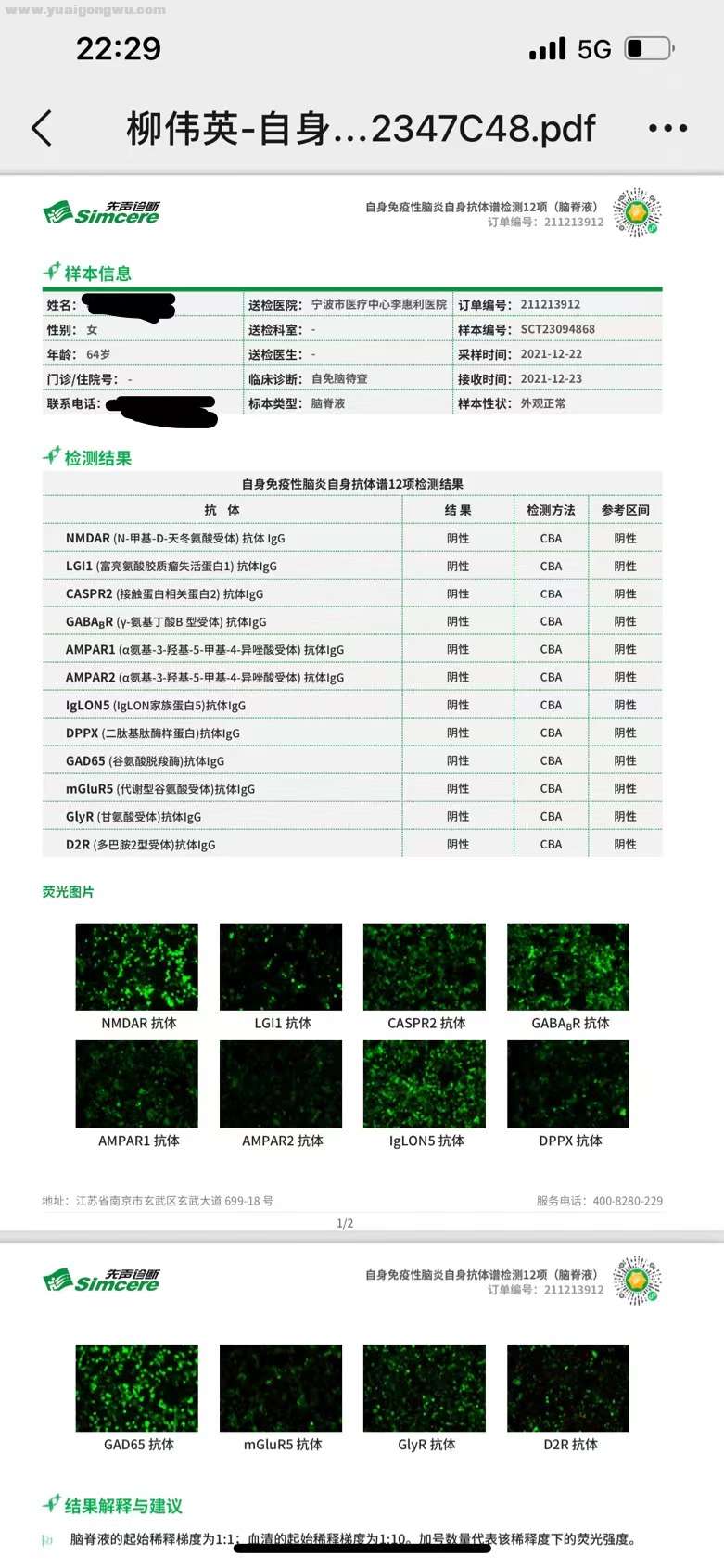 自身免疫性脑炎指标